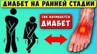 Так начинается диабет, первые звоночки! 10 признаков высокого сахара, 90% даже НЕ ЗНАЮТ, что у них