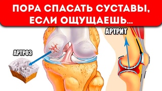 Как растворить желание артрита и артроза - разрушить ваши суставы