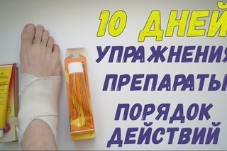 Восстановление голеностопа после растяжения ВСЕГО ЗА 10 ДНЕЙ!