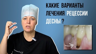Какие варианты лечения рецессии десны